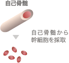 自己骨髄 自己骨髄から幹細胞を採取
